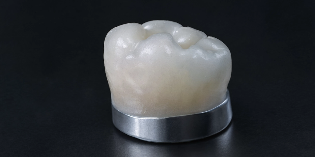 metallokeramicheskie-koronki1.png metallokeramicheskie-koronki1.png
