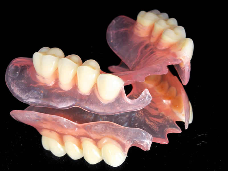 semnye-zubnye-protezy--osobennosti-vybora--izgotovleniya-i-ustanovki4.jpg
